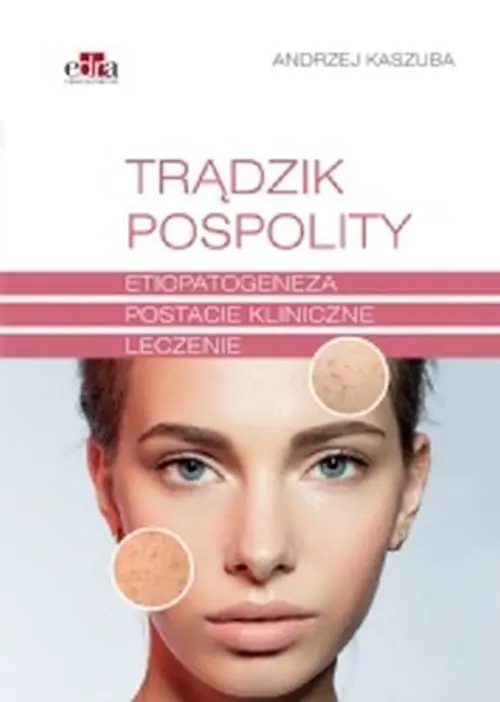 Trądzik pospolity Zamów teraz
