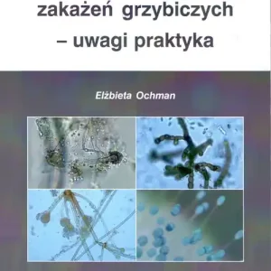 Diagnostyka zakażeń grzybiczych uwagi praktyka Darmowa dostawa